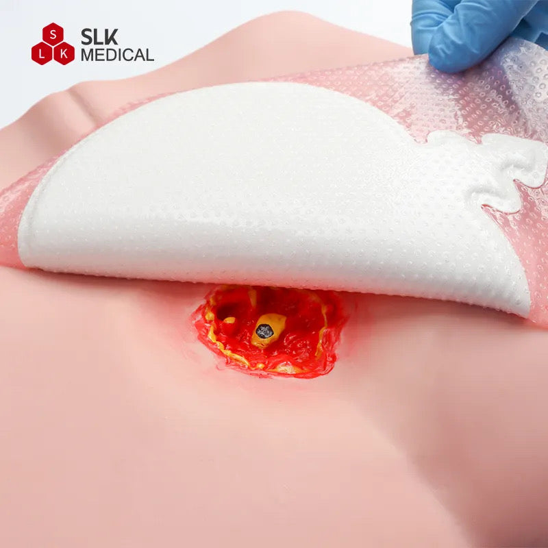 Alexer Super Absorbent Dressings
